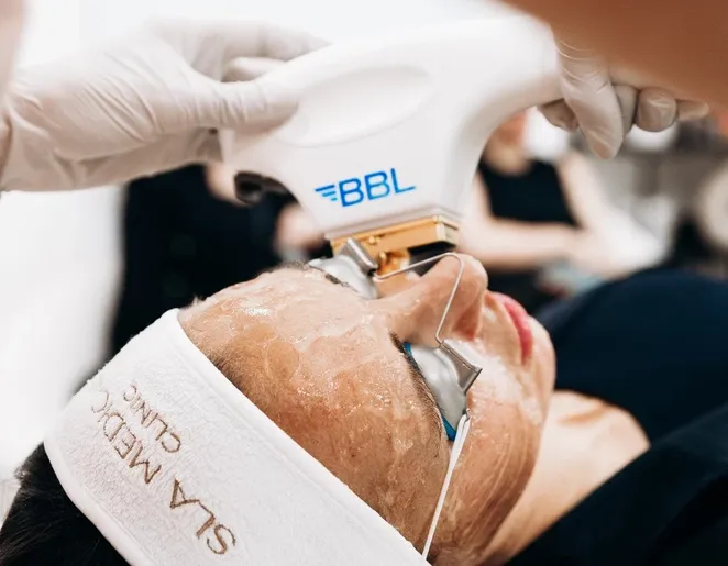 BBL Laser in Manchester – Youthful Skin Without Surgery