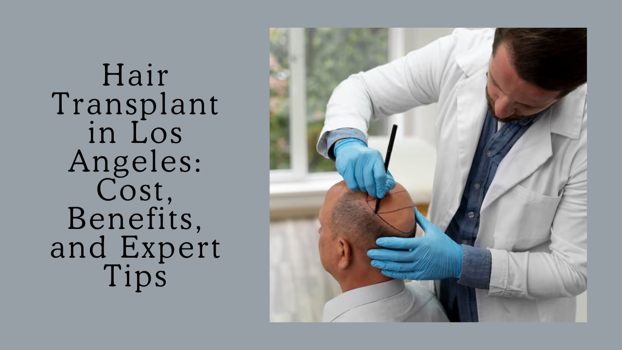 hair transplant los angeles